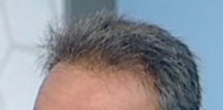 Καθαρές αποφάσεις