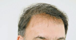 Απαραίτητες οι μεταρρυθμίσεις